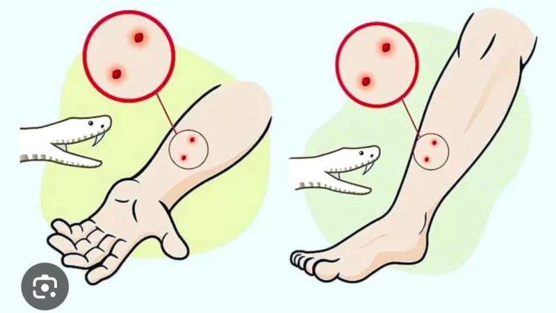 सांप डसे तो झाड़-फूंक में समय न गवाएं, तुरंत अस्पताल पहुंचे